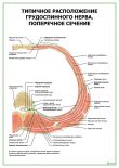 Типичное расположение грудоспинного нерва. Поперечное сечение
