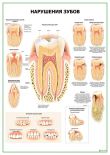 Нарушения зубов