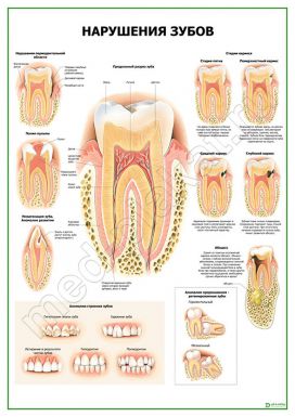 Нарушения зубов