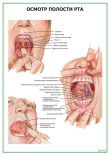Осмотр полости рта